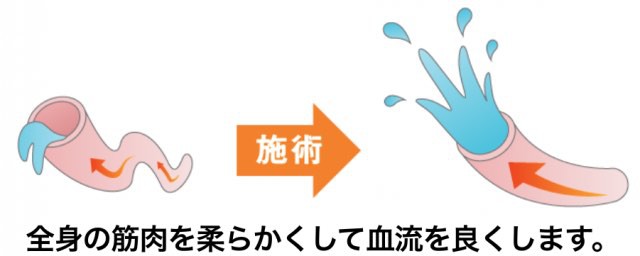 骨盤のゆがみを改善するため全身の血流を良くします。