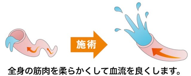 水戸の整体　CURAの施術血流改善