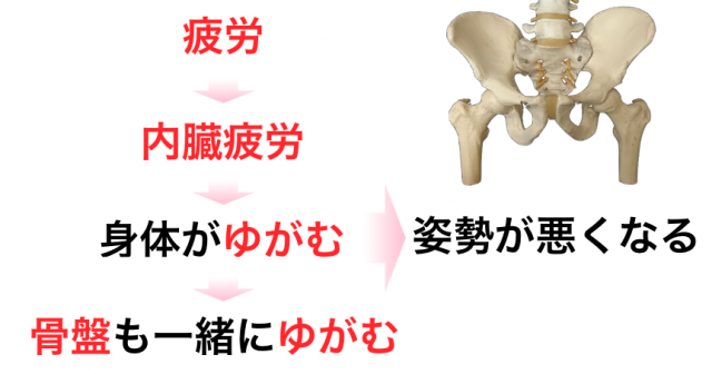 整体 CURAが考える骨盤がゆがむメカニズム