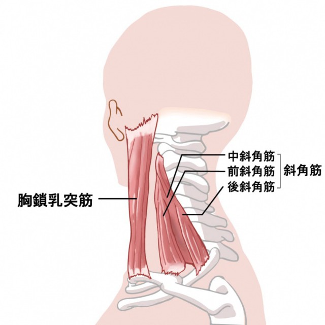 胸郭出口症候群の種類とは・・・