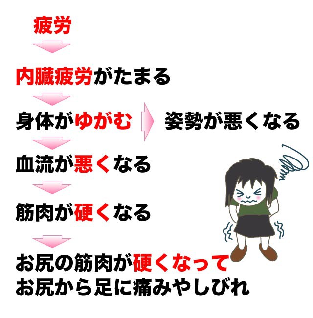 梨状筋症候群になってしまうメカニズム