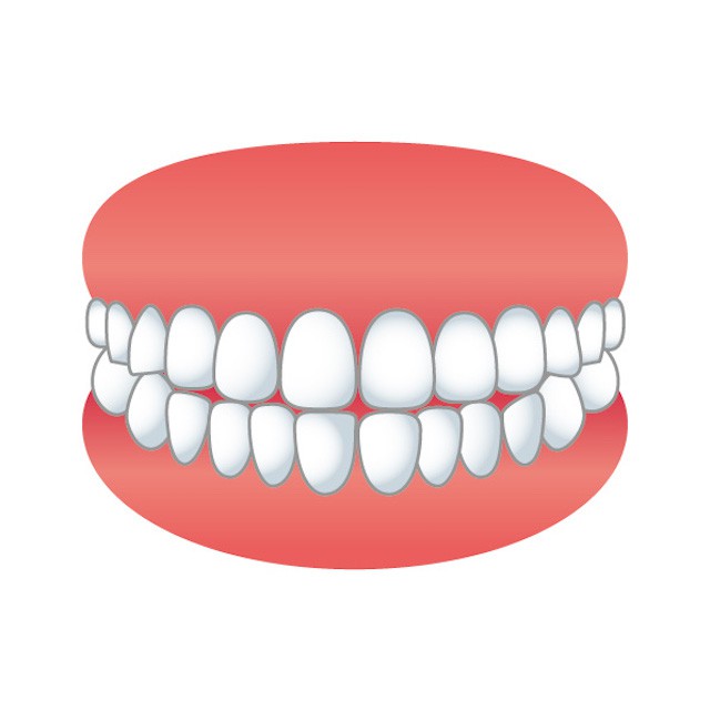 顎関節症　症状　噛み合わせがずれる