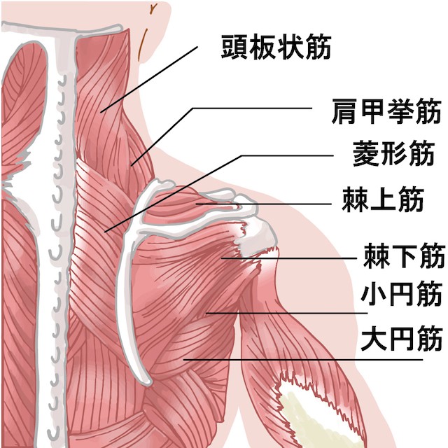 石灰沈着性腱板炎とは?